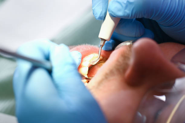 Best Same-Day Emergency Dental Services in Doe Valley, KY