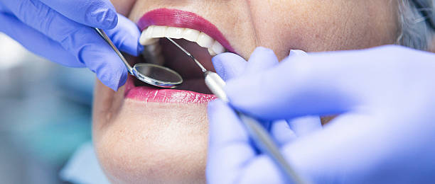 Best Emergency Dental Care for Broken or Chipped Teeth in Doe Valley, KY