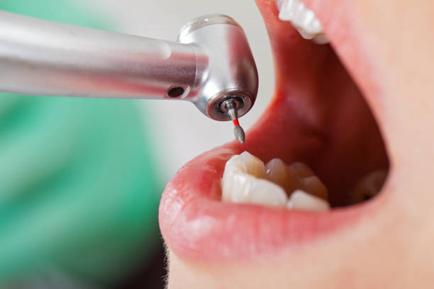 Best Cosmetic Emergency Dentistry in Doe Valley, KY